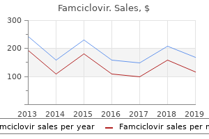 generic 250 mg famciclovir amex