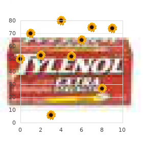 Brachymesophalangy 2 and 5