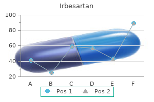 buy 150 mg irbesartan free shipping