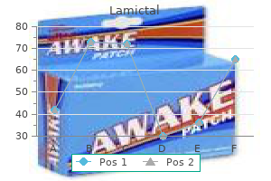 cheap lamictal 200 mg otc