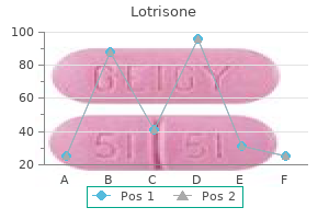 order lotrisone 10 mg mastercard