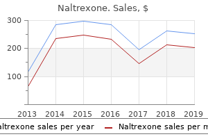 purchase 50 mg naltrexone with visa