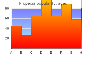 5mg propecia