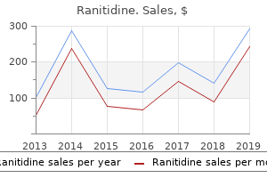buy ranitidine 150mg low cost