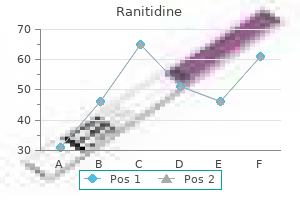 safe ranitidine 300 mg