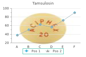cheap tamsulosin 0.4mg with visa