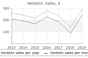 cheap 100 mcg ventolin mastercard